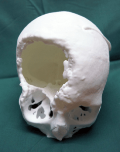 3d printed scull
