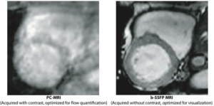 Cardiovascular MRI